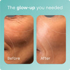 Biosil® Advanced Collagen Generator Original Capsules-N101 Nutrition